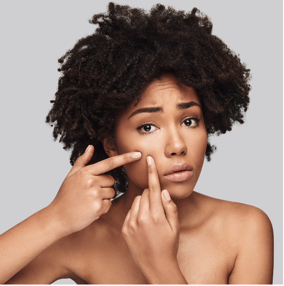 HOT WEATHER? DON’T WORRY ABOUT ACNE