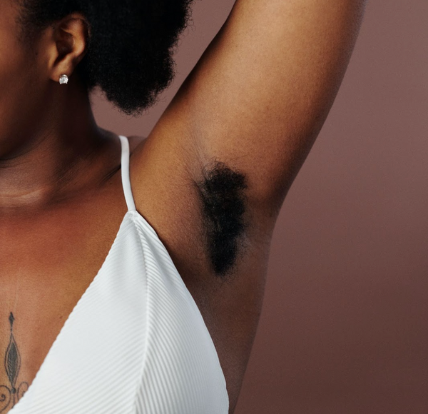 Everything You Need To Know About Ingrown Hairs